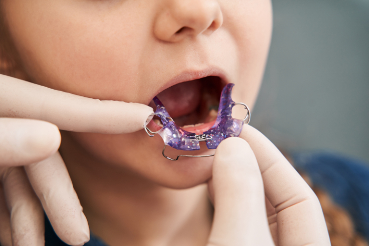 床矯正の治療の様子