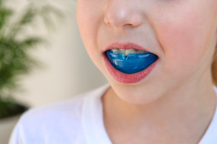 マイオブレースを装着した子どもの口元